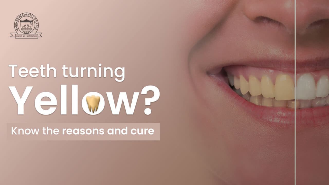Teeth turning yellow? Know the reasons and cure